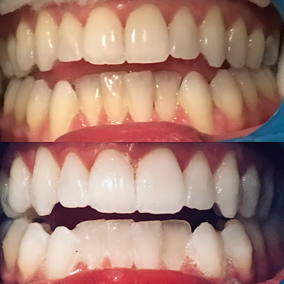 Bondi Bright Teeth Whitening - Opiniones